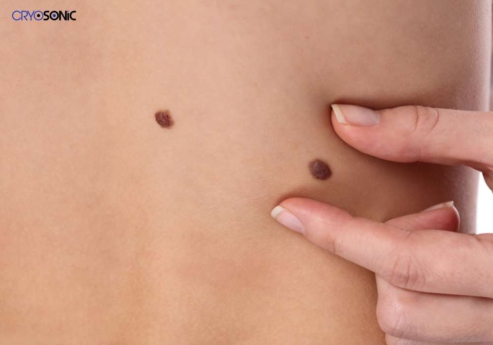 Infection Risk and Poor Aftercare Tamworth